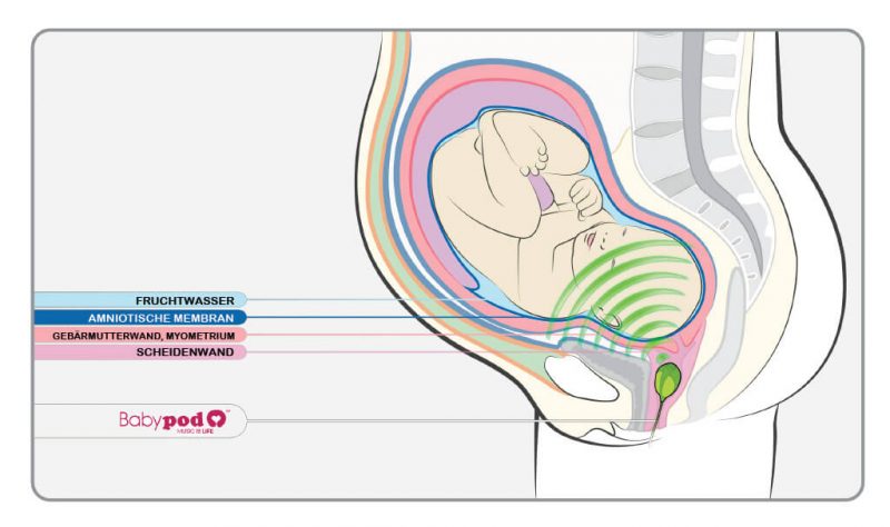 BabyPod-Altavoz-B-1_de
