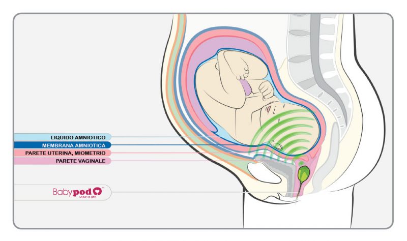 BabyPod-Altavoz-B-1_it