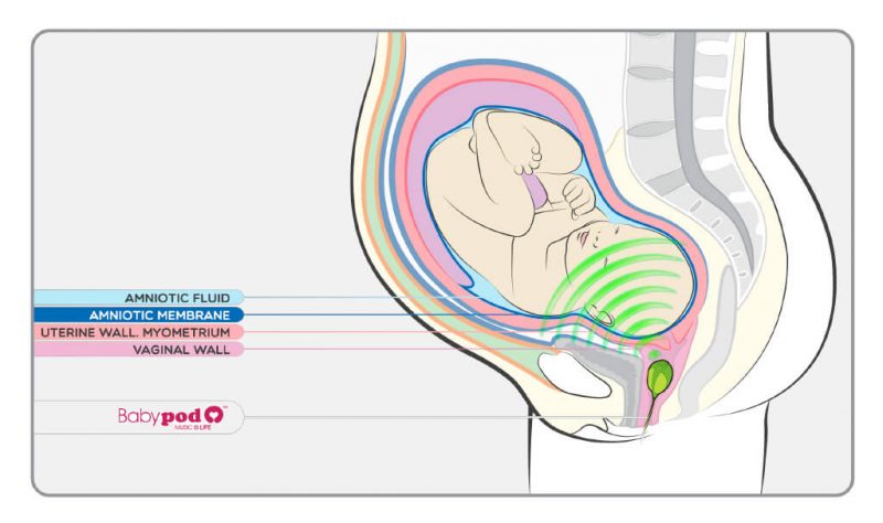 BabyPod-Altavoz-B-1_pt